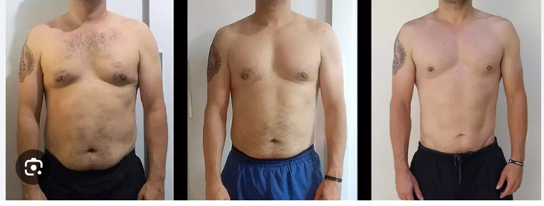 Client 1 six month weight loss and posture improvements (before and after)
