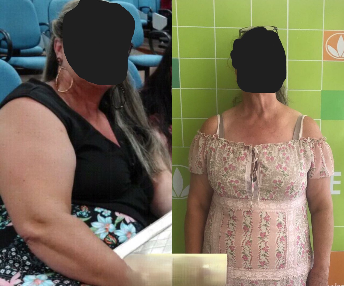 Client 10 increased shoulder and back definition (before and after)